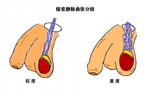 男科，关注男性健康，共创美好生活幸福篇章